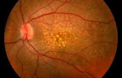 The Hidden Health Conditions Your Eye Test Can Detect