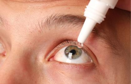 Dry Eye Explained: Causes, Symptoms & Treatments